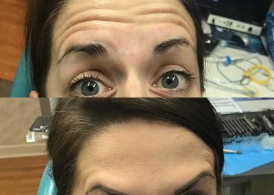 Before & After Microblading